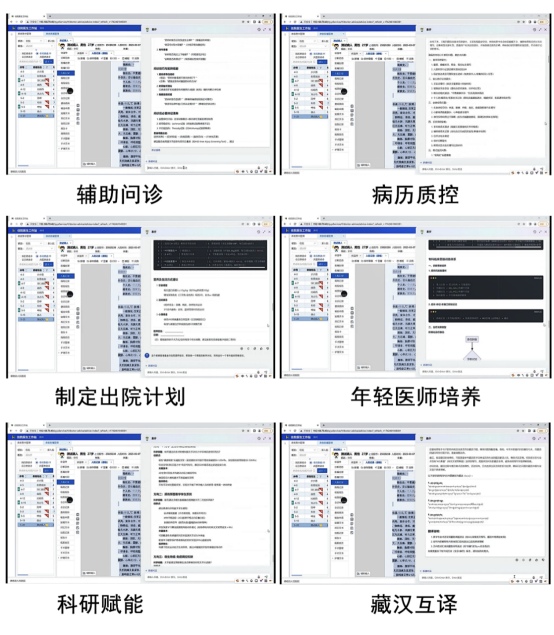 引入AI輔助診療系統。德格縣人民醫院供圖